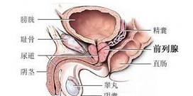前列腺疾病
